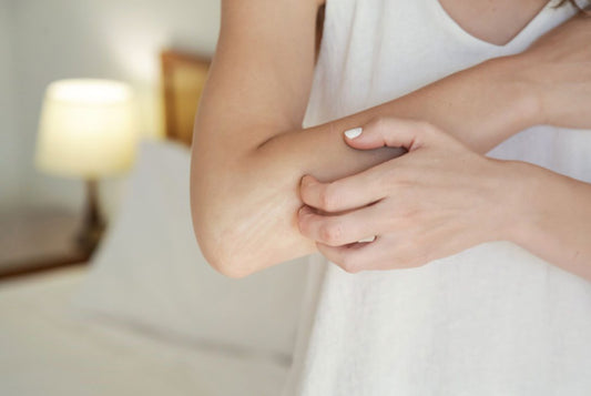 How Eczema Impacts Mental Health