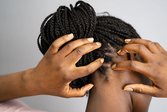 5 Scalp Myths You Can Stop Believing
