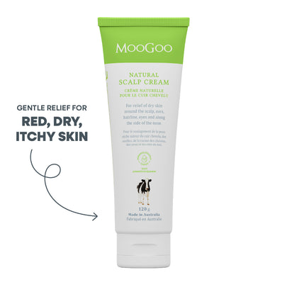 Dry Scalp Treatment Cream Relief of Itchy Scalp –